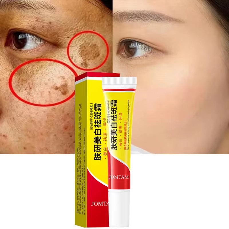 Whitening Freckle Cream Face B - Skincare Glad2Glow recensione e prezzo