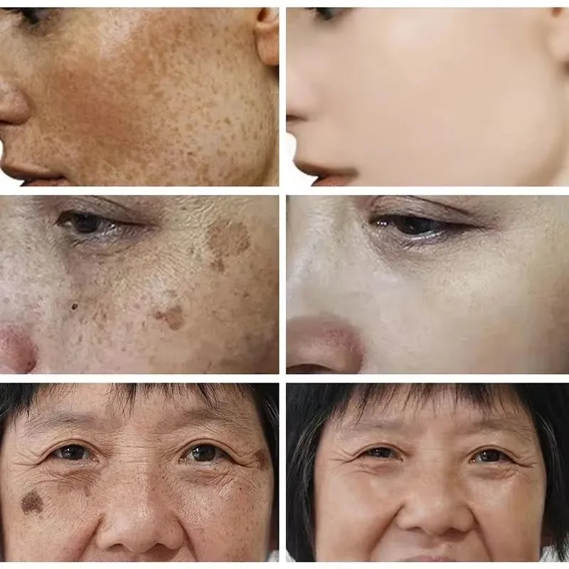 Whitening Freckle Cream Face B - Skincare Glad2Glow recensione e prezzo
