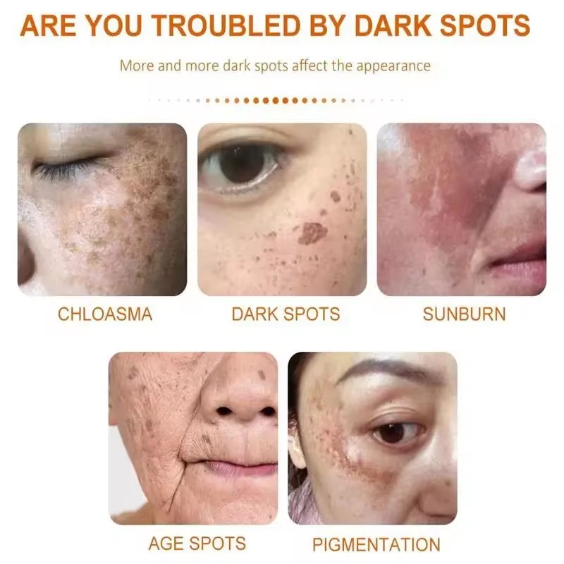 Whitening Freckle Cream Face B - Skincare Glad2Glow recensione e prezzo