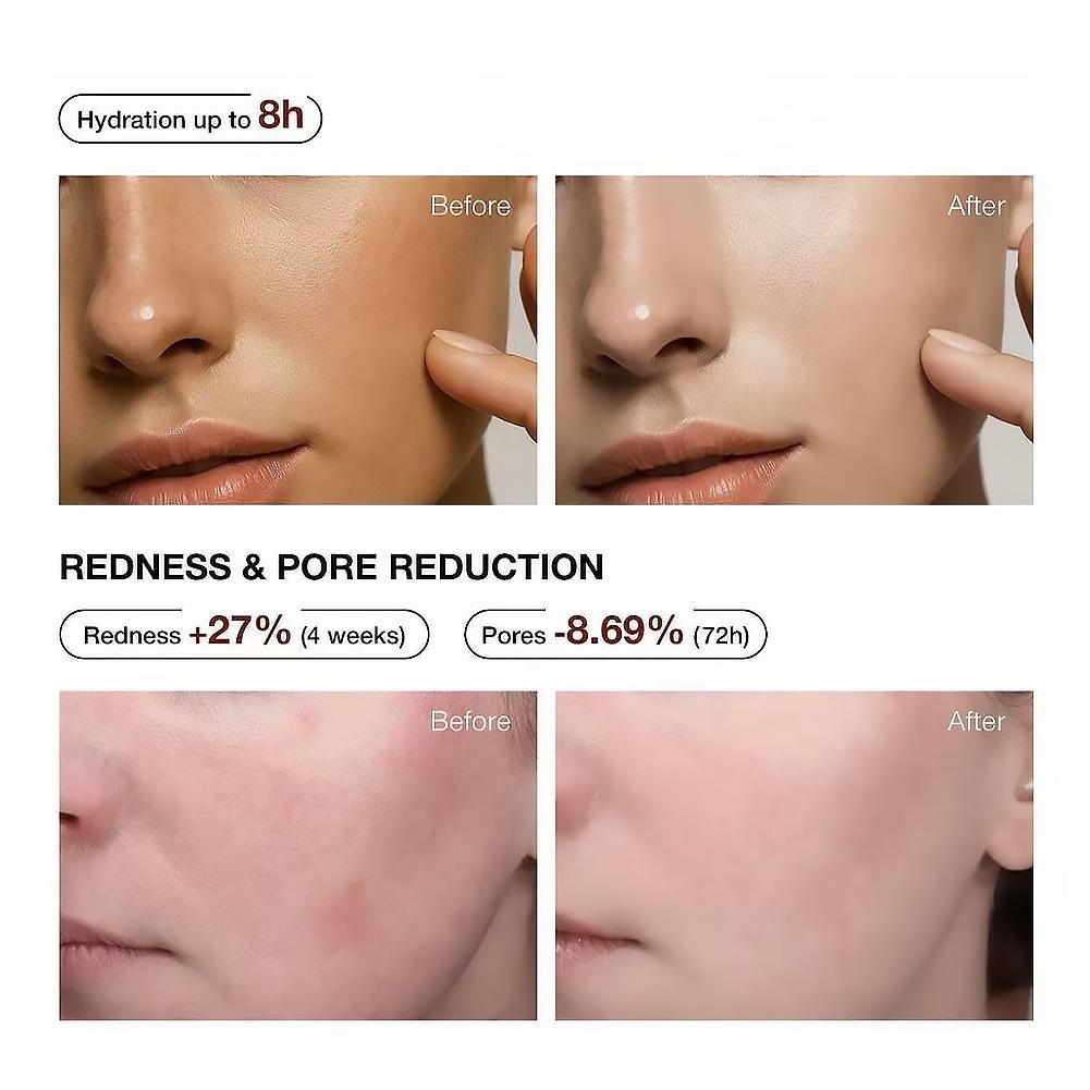 5% Niacinamide & Arbutin Serum - Niacinamide Brightening Serum recensione e prezzo