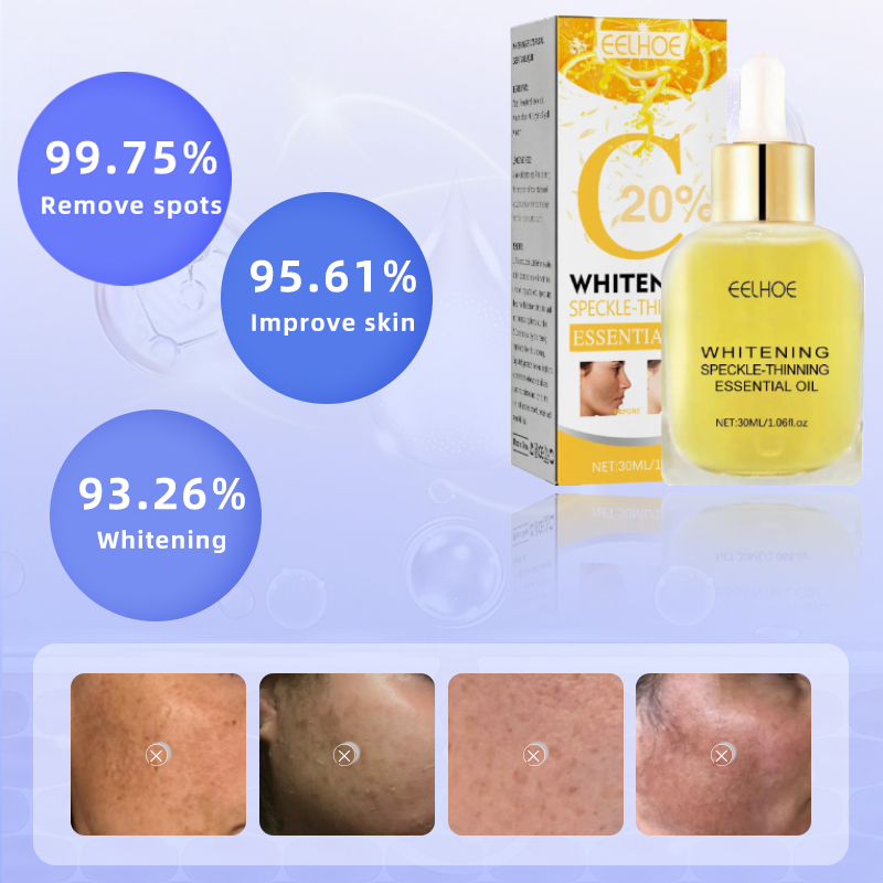 Dark Spots, Lighten Freckles M - Skincare Glad2Glow recensione e prezzo