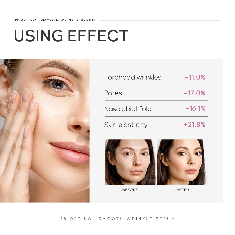 Quiyum 1% Retinol Smooth Wrink - Niacinamide Brightening Serum recensione e prezzo